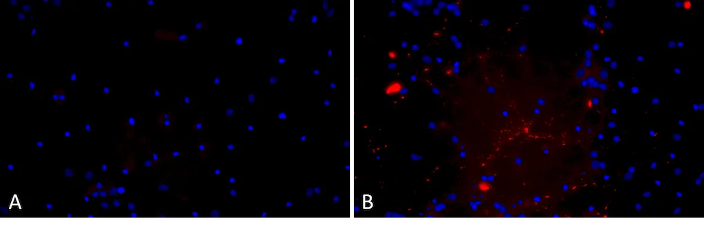 Alpha Synuclein A53T Mutant Pre-formed Fibrils (Type 1) - image 1