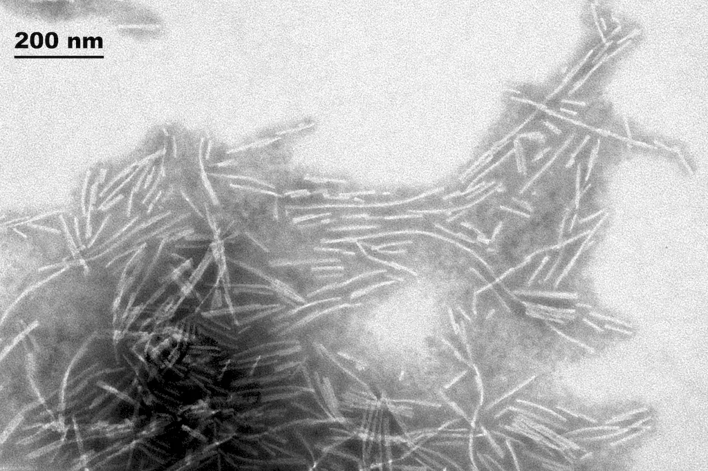 Alpha Synuclein Filaments - image 2
