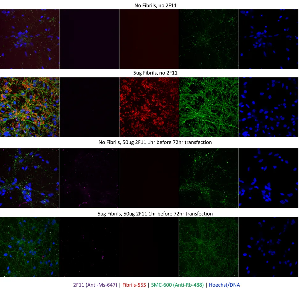 Alpha Synuclein Antibody (Aggregate-Specific): RPE - image 3