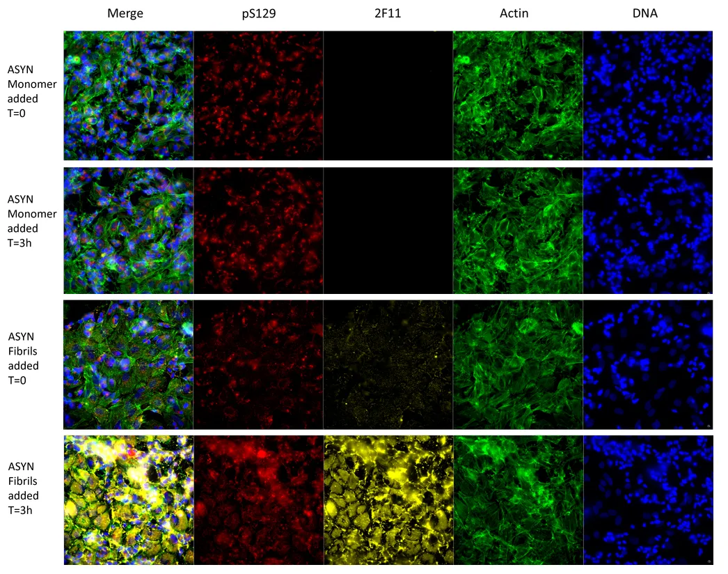 Alpha Synuclein Antibody (Aggregate-Specific): RPE - image 4