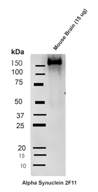 Alpha Synuclein Antibody (Aggregate-Specific): RPE - image 6