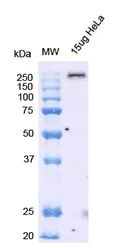 Alpha Synuclein Antibody (Aggregate-Specific): RPE - image 7