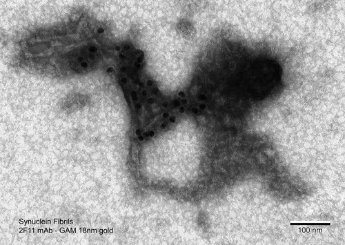 Alpha Synuclein Antibody (Aggregate-Specific): RPE - image 1