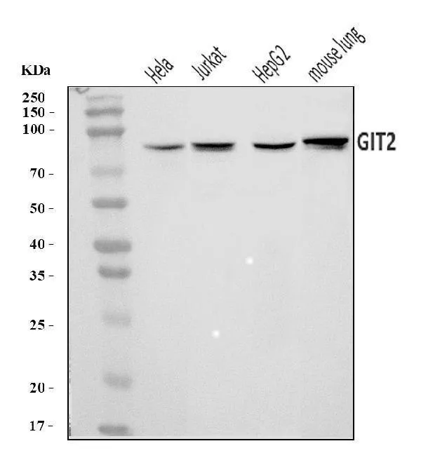 Anti-GIT2 Antibody Picoband®