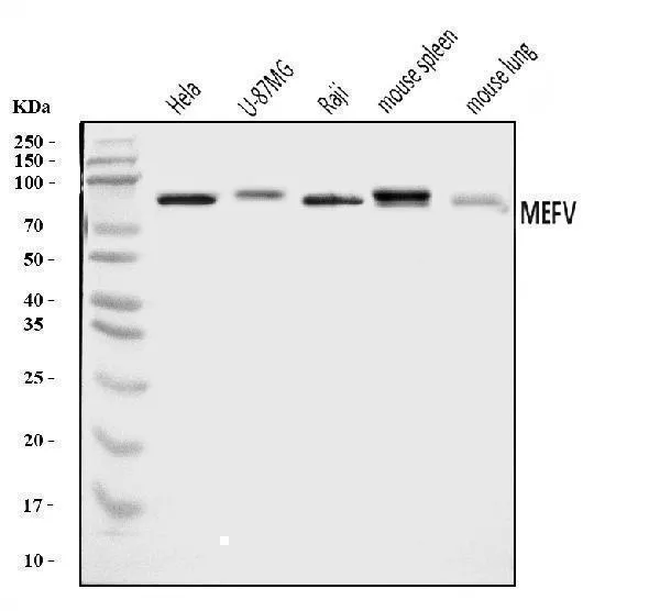 Anti-Pyrine/MEFV Antibody Picoband®