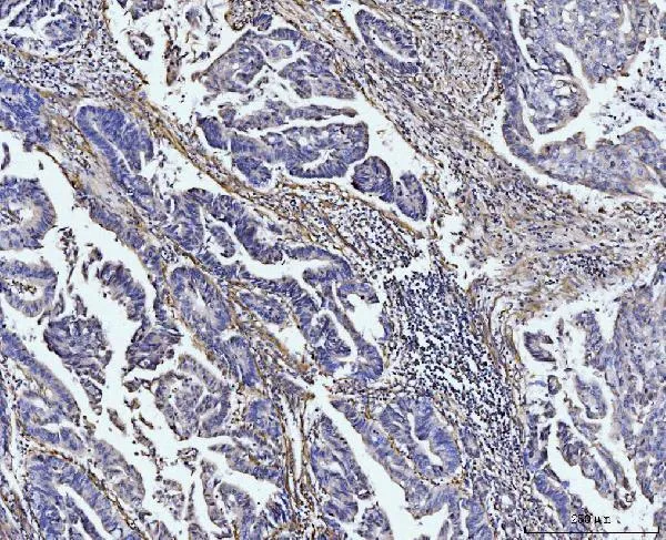 Anti-COL4A2 Antilichaam