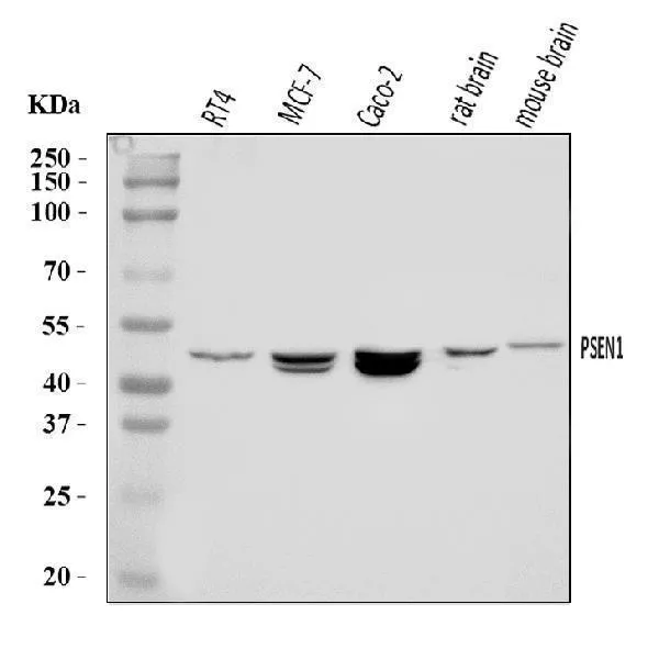 Anti-Preseniline 1/PS-1/PSEN1 Antibody Picoband®