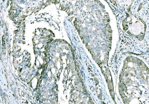 Anti-CD101 Antilichaam