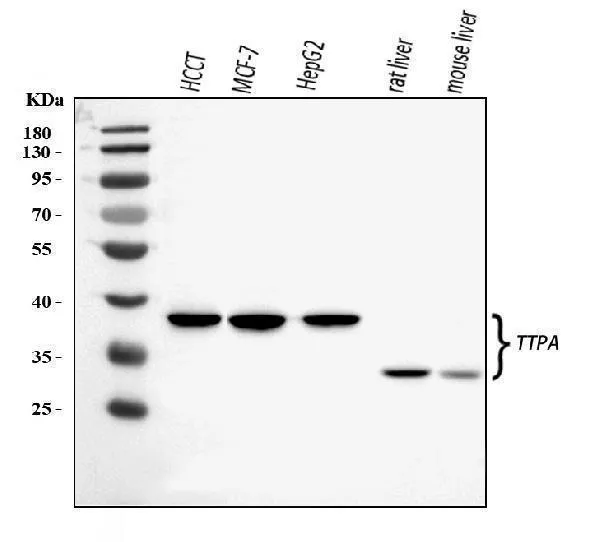 Anti-TTPA/TPP1 Antibody Picoband®