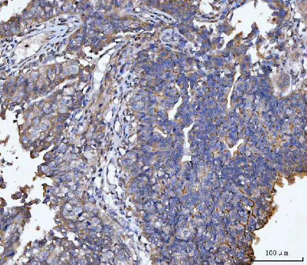 Anti-MUC1 Antilichaam