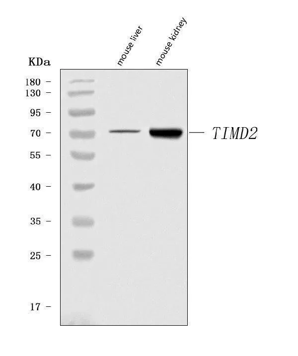 Anti-Tim 2/Timd2 Antibody Picoband®