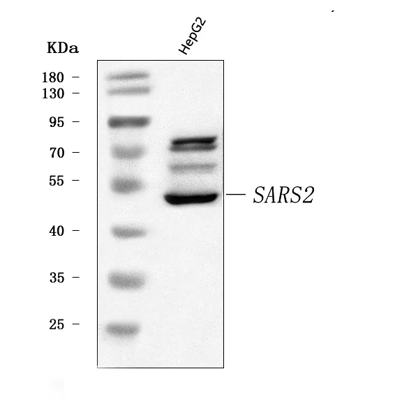 Anti-SARS2 Antibody Picoband®