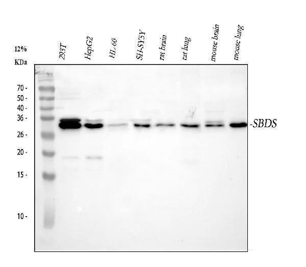 Anti-SBDS Antibody Picoband®