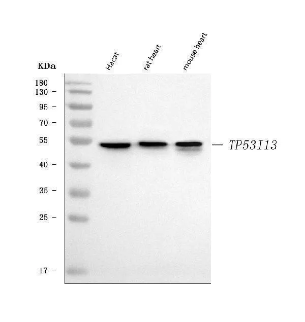 Anti-TP53I13 Antibody Picoband®