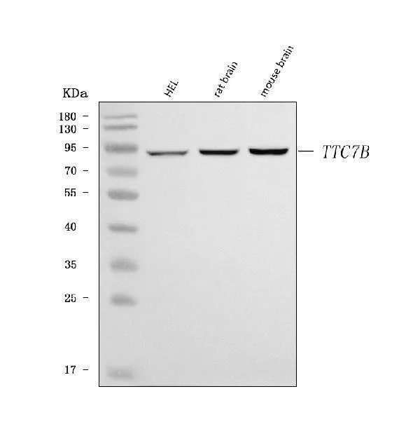 Anti-TTC7B Antibody Picoband®