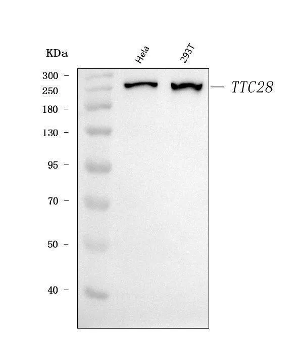 Anti-TPRBK/TTC28 Antibody Picoband®