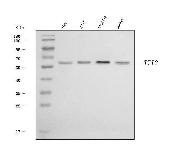 Anti-TTI2 Antibody Picoband®