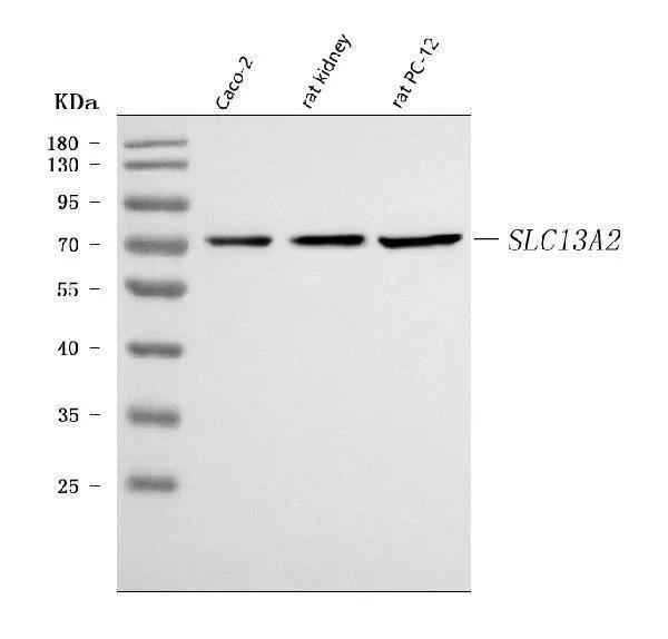 Anti-NaDC-1/SLC13A2 Antilichaam Picoband®
