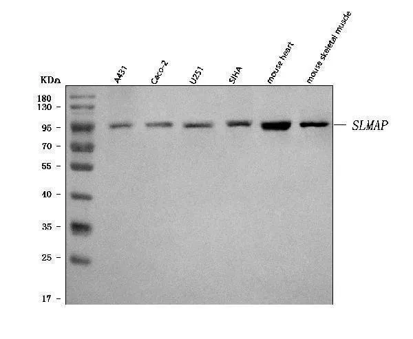 Anti-SLMAP Antibody Picoband®