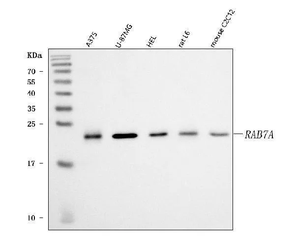 Anti-RAB7/RAB7A Antibody Picoband®