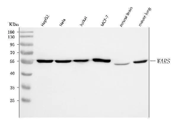 Anti-WRS/WARS1 Antibody Picoband®