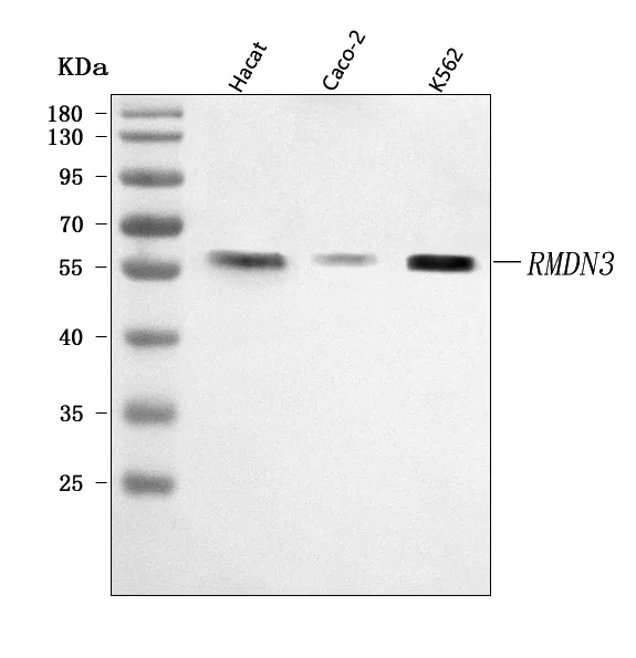 Anti-PTPIP51/RMDN3 Antibody Picoband®