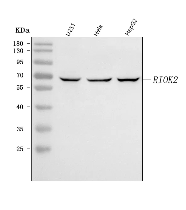 Anti-RIOK2 Antilichaam Picoband®