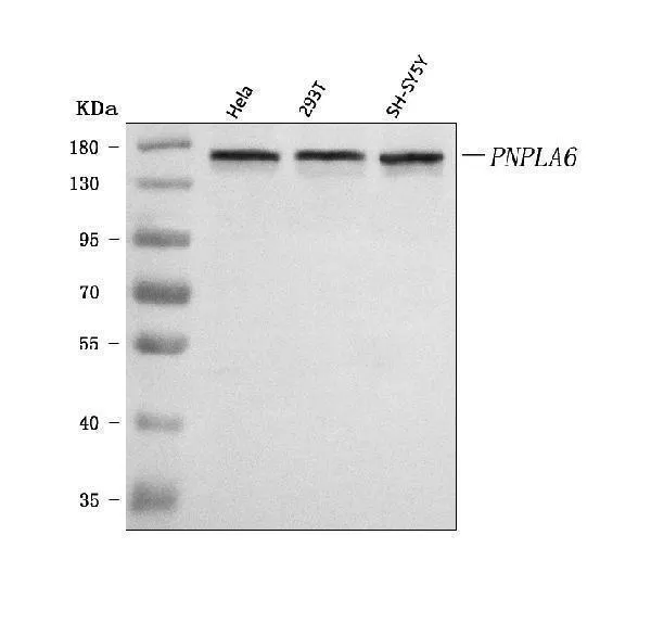 Anti-PNPLA6 Antibody Picoband®