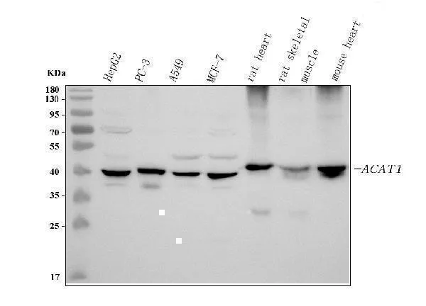 Anti-ACAT1 Antibody Picoband®