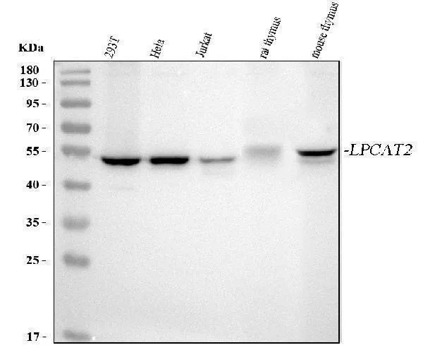 Anti-LPCAT2 Antibody Picoband®