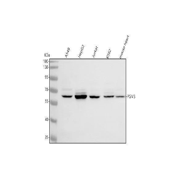 Anti-PGM3 Antibody Picoband®