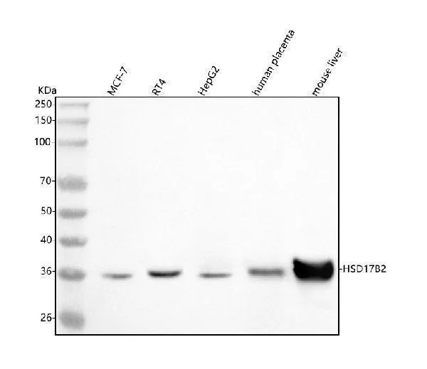 Anti-HSD17B2 Antibody Picoband®