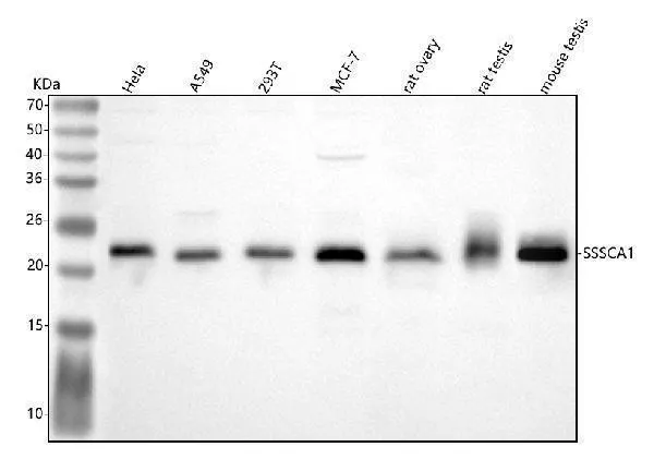 Anti-SSSCA1/ZNRD2 Antibody Picoband®