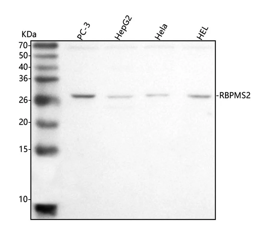 Anti-RBMMS2 Antibody Picoband®