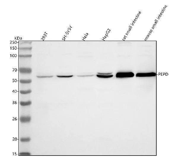 Anti-PEPD Antibody Picoband®