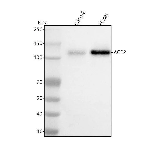 Anti-ACE2 Antibody Picoband®