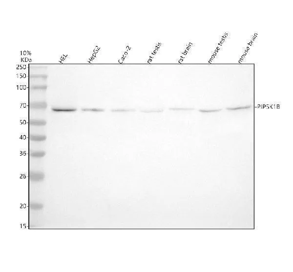 Anti-PIP5K1B Antibody Picoband®