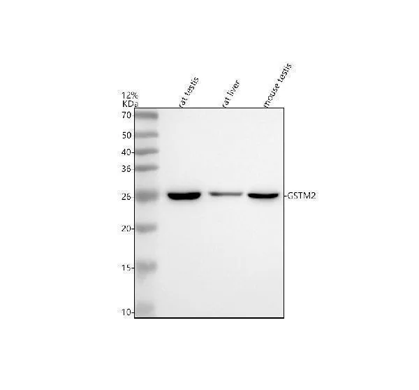 Anti-GSTM2 Antibody Picoband®