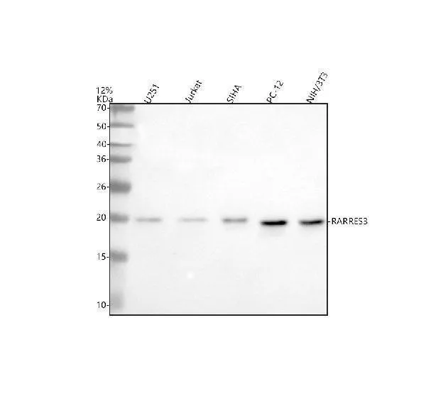 Anti-RARRES3/PLAAT4 Antibody Picoband®