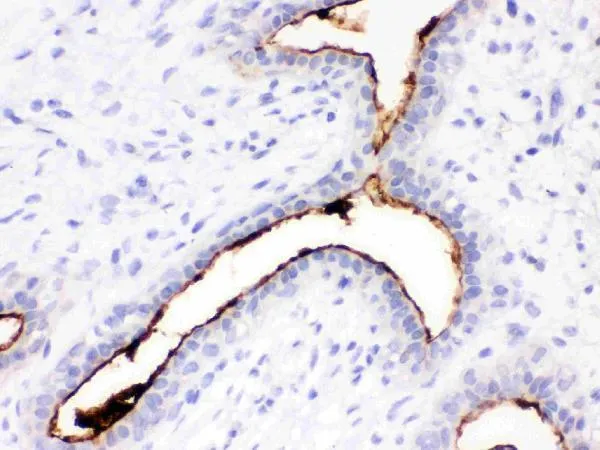 Anti-episialine, EMA MUC1 Antilichaam (monoclonaal, GP1,4)