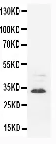 Antisynaptophysin Syp Antilichaam (Monoclonal, SVP-38)