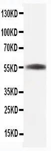 Anti-Beta-Tubulin TUBB1 Antilichaam (monoclonaal, TUB 2.1)