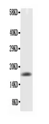 Anti-TNF alpha Antibody Picoband®