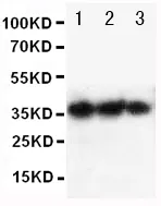 Anti-EPO/Erytropoëtine Antibody Picoband®