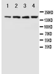 Anti-NMDAR2B/GRIN2B Antibody Picoband®