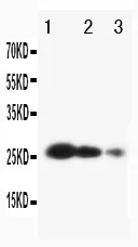Anti-Metalloproteïnaseremmer 3 TIMP3 Antibody Picoband®