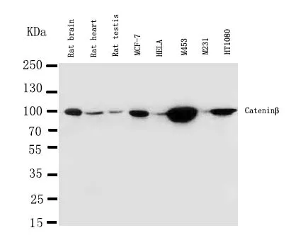 Anti-beta Catenin/CTNNB1 Antibody Picoband®
