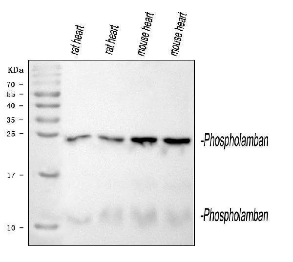 Anti-Phospholamban/PLN Antibody Picoband®