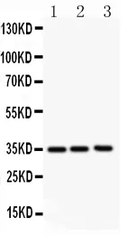 Anti-GM-CSF/CSF2 Antibody Picoband®