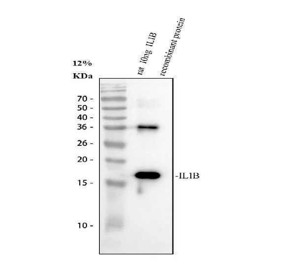 Anti-IL1 beta/IL1B Antibody Picoband®